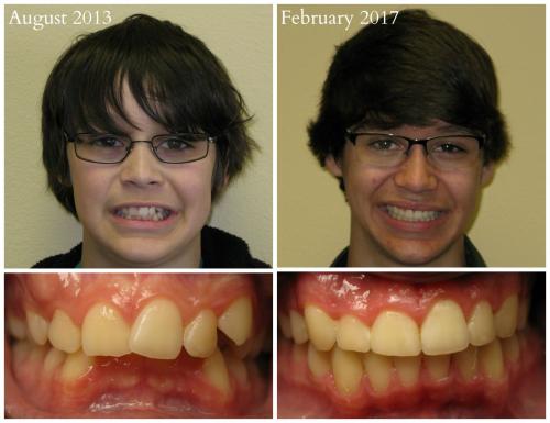 2017-02Fischer, Colten