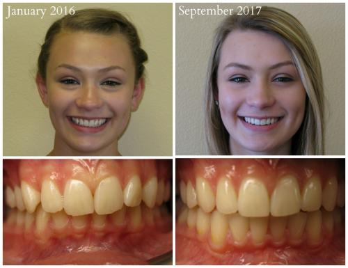 2017-09Mahoney, Teeghan