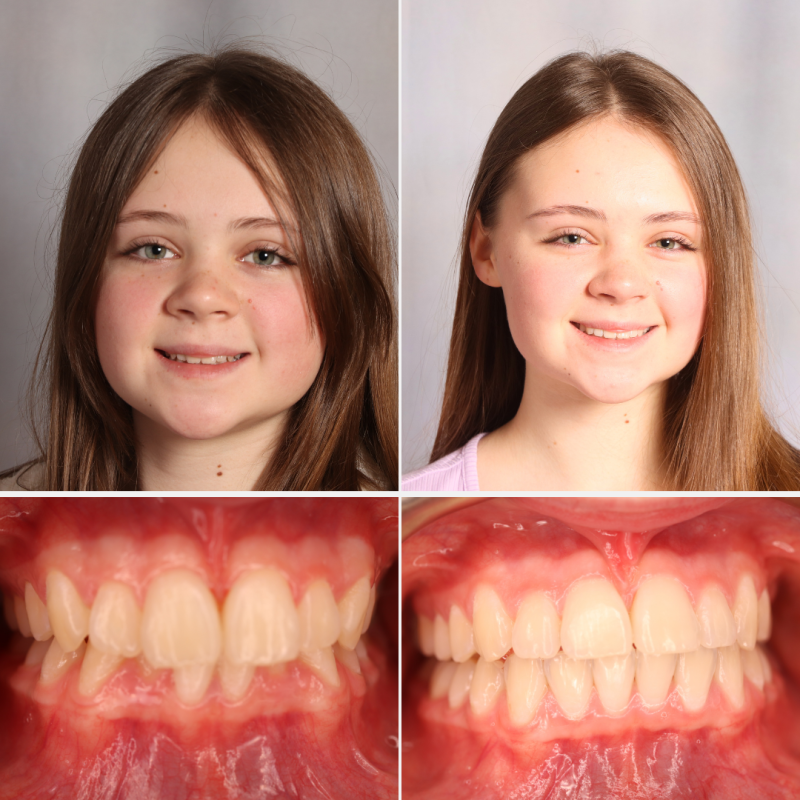 Ortho BA 1